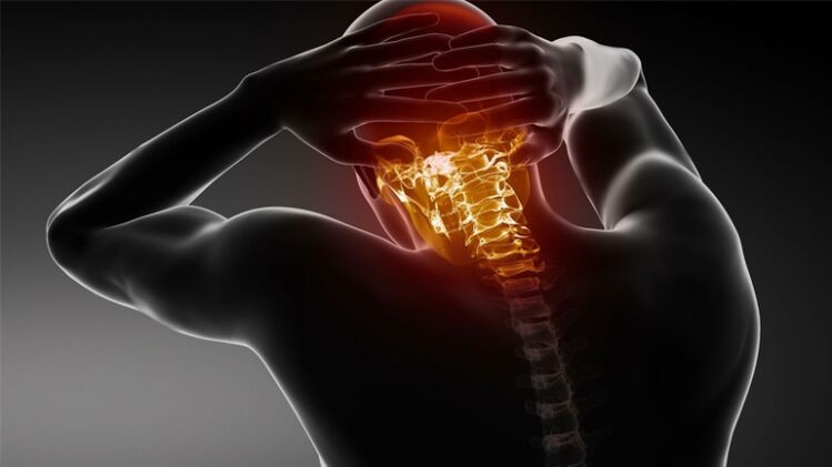 skausmas pakaušyje su gimdos kaklelio osteochondroze